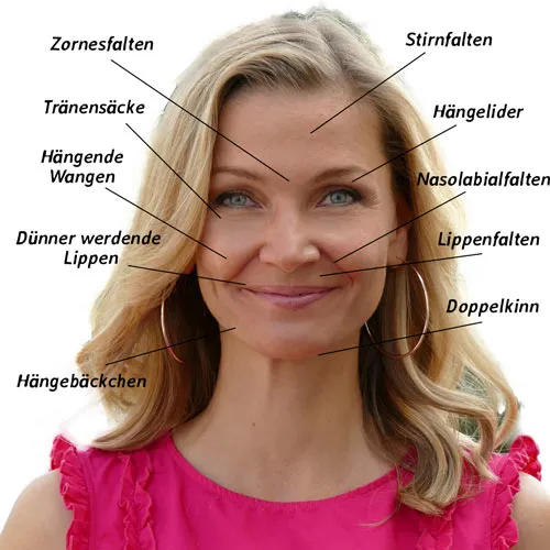 Gesicht einer Frau mit Markierungen, gegen was Chi statt Botox helfen soll, z. B. Stirnfalten, Hängelider und Doppelkinn