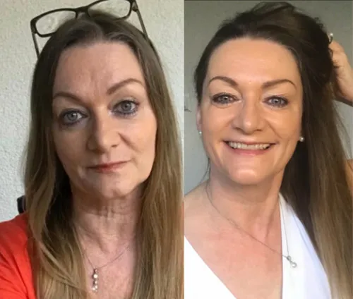 Vorher-Nachher-Bild einer Kundin des Chi statt Botox Video-Kurses mit strafferen Gesichtszügen